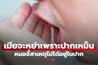 สาเหตุปากเหม็นไม่ได้อยู่ที่ฟัน อาจมาจากโพรงจมูกหรือระบบทางเดินอาหาร